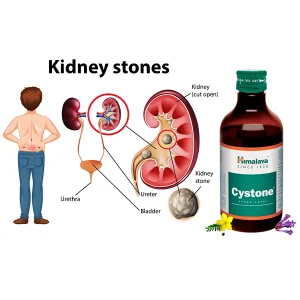 Himalaya Cystone Syrup